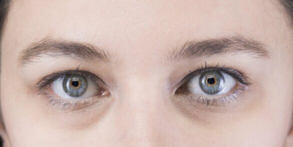 Comment avoir le blanc des yeux très blanc ?