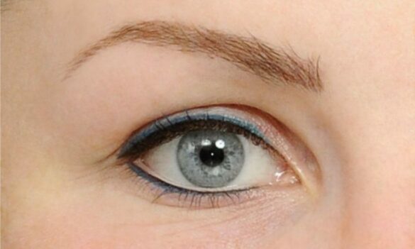 Comment corriger les imperfections du visage ?