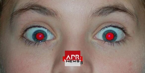 Comment corriger les yeux rouges sur les photos ?