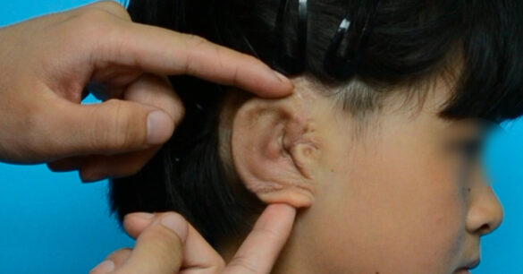 Comment distinguer le A et le à ?