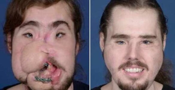 Comment mettre sa tête en flou ?