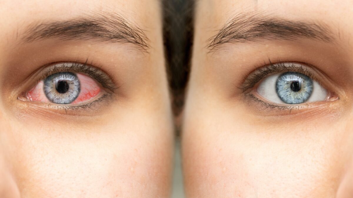 Comment modifier les yeux rouges sur une photo iphone ?