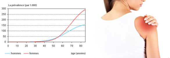 Est-ce que le 32 44 est gratuit ?