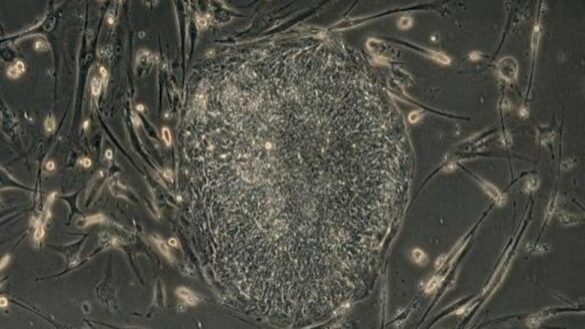 Pourquoi WhatsApp baisse la qualité des photos ?