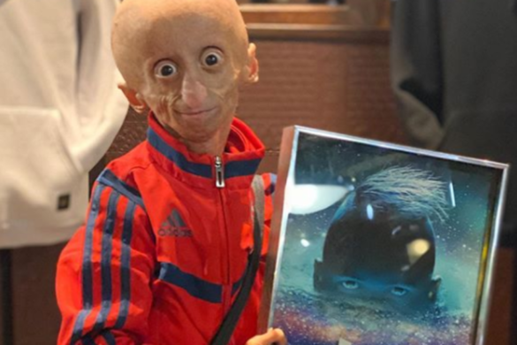 Quelle maladie à Logan ?